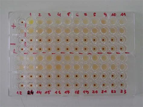 Treponema pallidum particle agglutination assay - Wikiwand