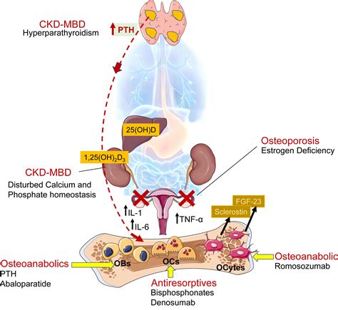 Metabolic Bone Disease Icd 10 - Pregnant Health Tips