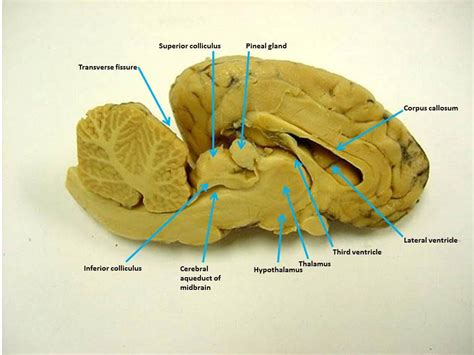 Lateral Ventricle Sheep Brain | Hot Sex Picture