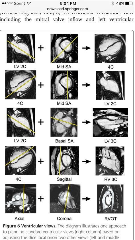 Cardiac MRI | Cardiac sonography, Radiology imaging, Radiology