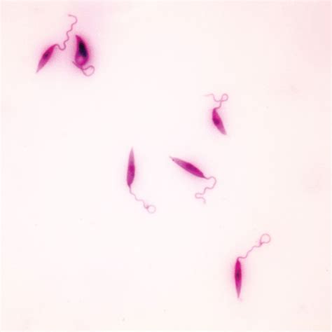 Buy Leishmania donovani Smear Microscope Slide Online at Low Prices in ...