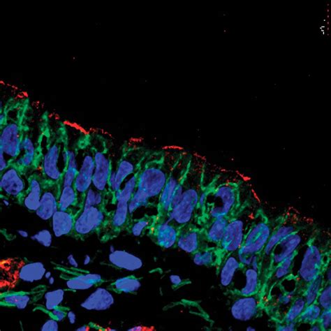 Using gene therapy to treat cystic fibrosis