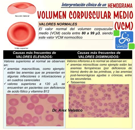 INTERPRETACIÓN CLÍNICA DE UN HEMOGRAMA ~ Dr. Alex Velasco