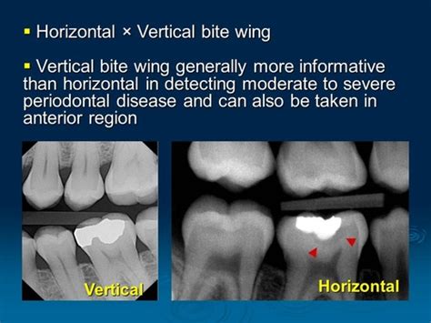 Unit 5 ( Lesson 5.2 Dental Rad. Images, Imaging Devices and Equipment ...