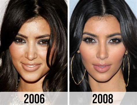 Kim Kardashian Then & Now: See How Much Her Face Has Changed Over The ...