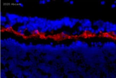 Anti-LAMP1 antibody - Lysosome Marker (ab24170) | Abcam