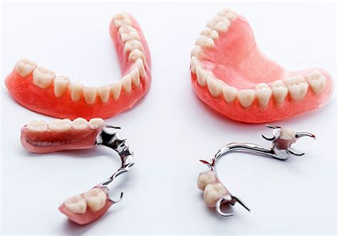 Dentures: Get The Best Dentures From Colby Dental and Improve Your ...