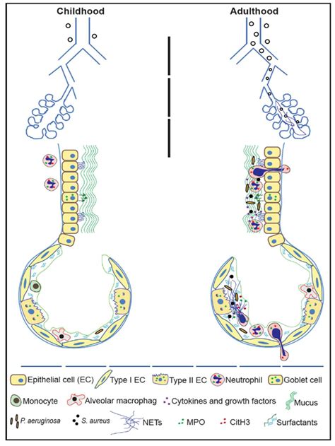 Genes | Free Full-Text | Progression of Cystic Fibrosis Lung Disease from Childhood to Adulthood ...