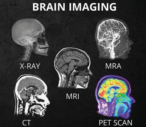 an image of brain images and their corresponding functions in the human body, including mris