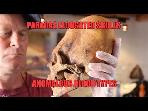 Paracas Elongated Skulls: They Were Not 100% Native American - Hidden Inca Tours