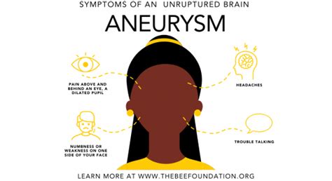 About Brain Aneurysms - The Bee Foundation