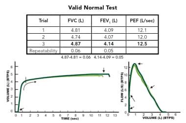 Spirometry Normal Values Chart