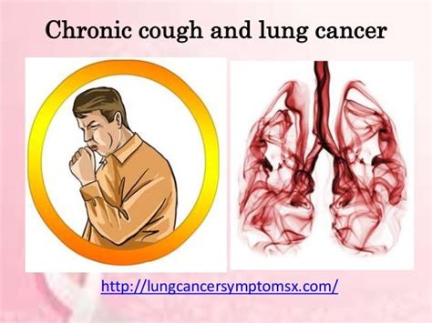 Chronic cough and lung cancer