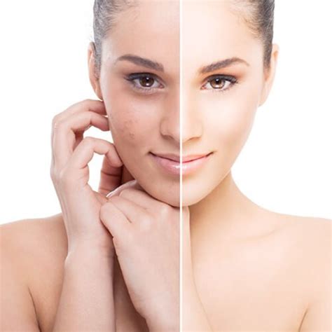 Frequent Facial Treatment - New York Skin Solutions