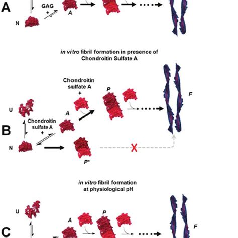 Light chain amyloidosis pathology. Clonal expansion of plasma cells ...