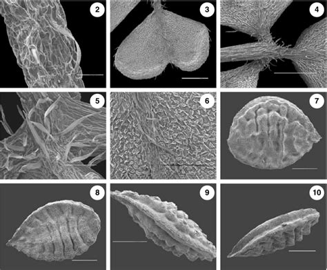 SEM pictures of Oxalis ferae sp. nov. Collection details. Fig. 2.... | Download Scientific Diagram