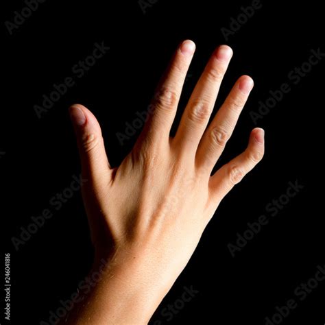 Woman hand with the pinky little finger due to arthritis Stock Photo | Adobe Stock