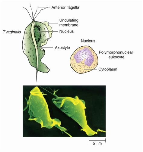 53 Sarcomastigophora—The Flagellates | Basicmedical Key