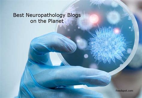 Top 5 Neuropathology Blogs and Websites To Follow in 2021