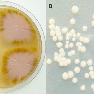 Aureobasidium pullulans: a. Melanised hyphae with groups of melanised... | Download Scientific ...