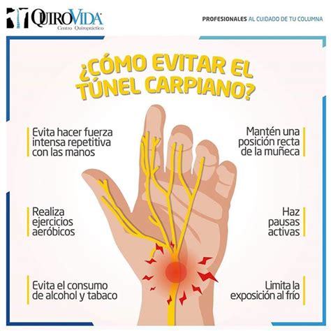 Túnel carpiano – Quirovida