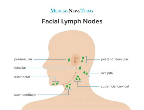 Pin by Christine Haden on Glands lymph/sinuses in 2020 | Lymph nodes ...