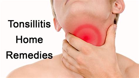 Tonsilitis Treatment