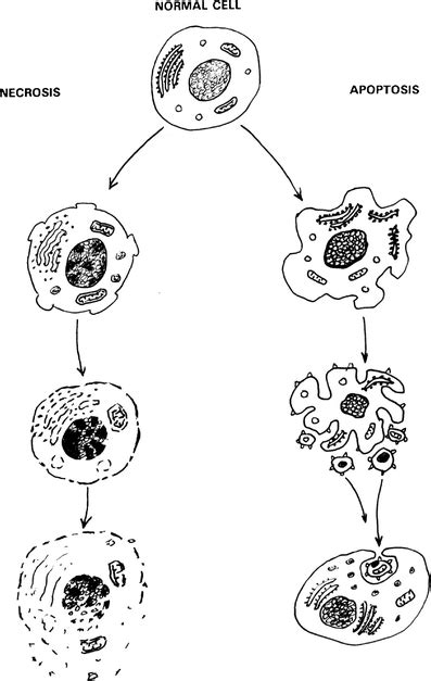 Schematic representation of the different stages of nec | Open-i