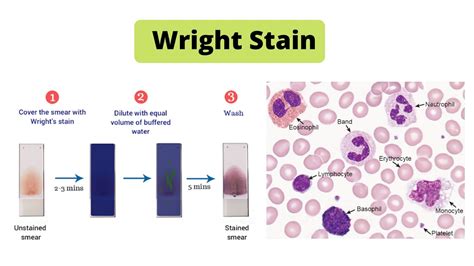 Wright Stain Principle, Procedure, Result – Microbiology Notes