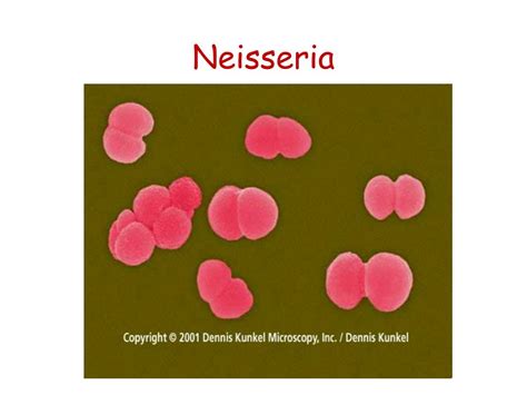 PPT - Neisseria PowerPoint Presentation, free download - ID:3121064