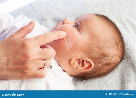 Baby with Atopic Dermatitis Getting Cream Put. Care and Prevention of Eczema Stock Image - Image ...