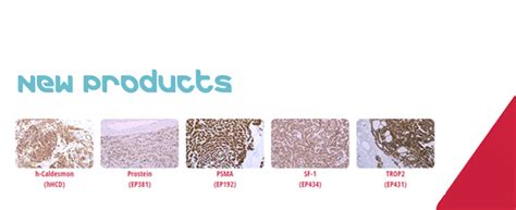 New Antibodies Available From Cell Marque - Abacus dx