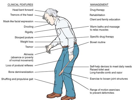 In Parkinson’s anxiety medications can lead to increased rigidity and ...