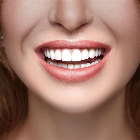 Veneers Cost Scottsdale, AZ - Phoenix, AZ - Dental Works