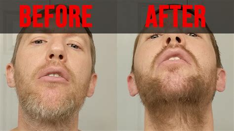 Before-After-Beard - My Legit Reviews