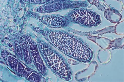 Antheridia of Moss - Stock Image - C009/3400 - Science Photo Library