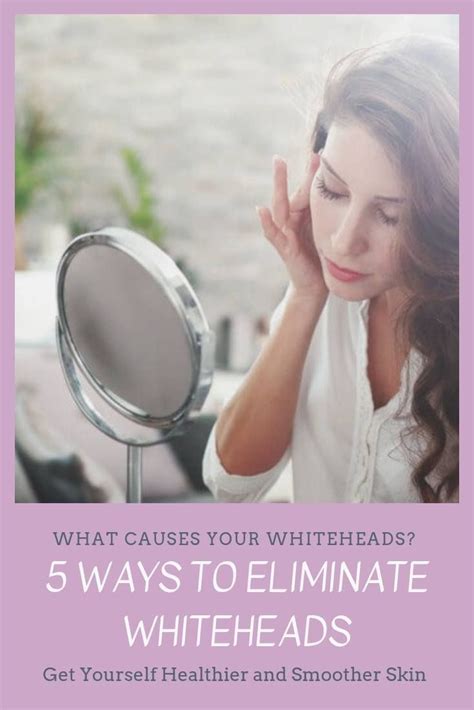 5-ways-to-eliminate-whiteheads #whiteheadsacne