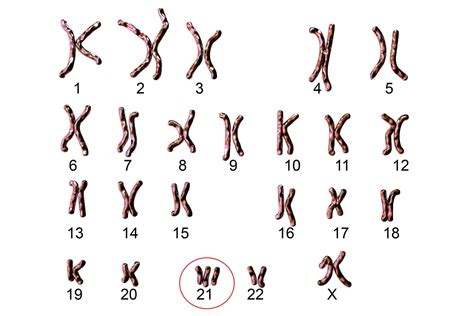 Karyogramm (Chromosomenanalyse) • Störungen erkennen