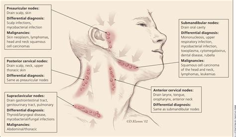 Posterior Cervical Lymph Nodes Swollen Causes