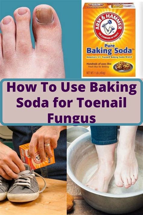 Baking Soda for Toenail Fungus | Care Tips For Toenail Fungus | Toenail fungus, Baking soda, Toe ...