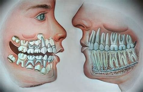 Mixed Dentition | News | Dentagama