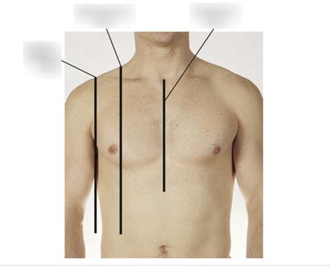 Reference Lines for Anterior Chest Diagram | Quizlet