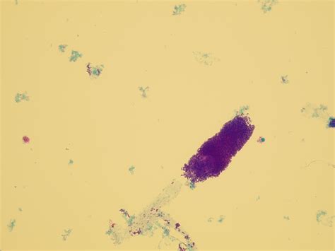 Microscopic Analysis of Urine | Faculty of Medicine, Masaryk University