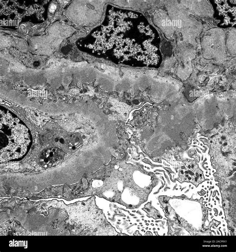 Intraglomerular mesangial cells. Transmission electron micrograph (TEM) of a section through ...