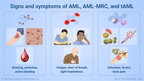 Slide Show - Diagnosing AML, AML-MRC, and tAML