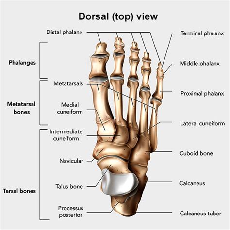 Midfoot Fusion: Orthopedic Surgery for Arthritis Pain