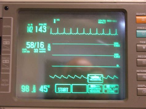 All about medicine: ICU Monitor