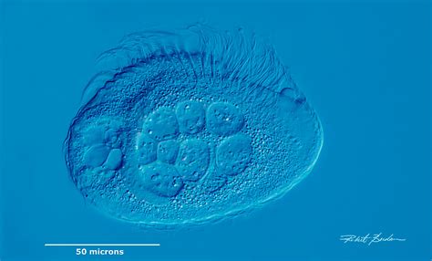 Differential Interference Contrast Microscopy (DIC) - The Canadian Nature Photographer - Robert ...