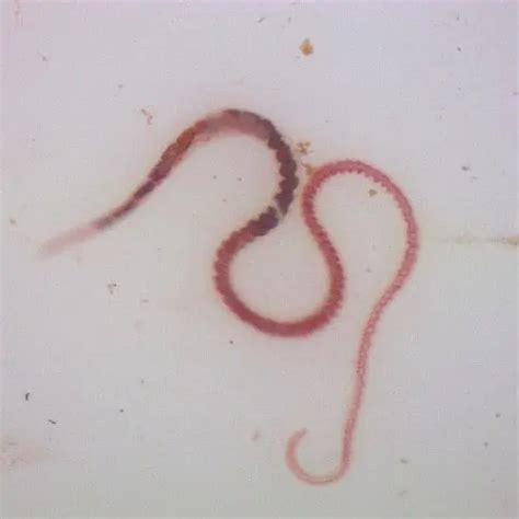 Aquatic Worms Facts (Limnodrilus hoffmeisteri) - Pond Informer