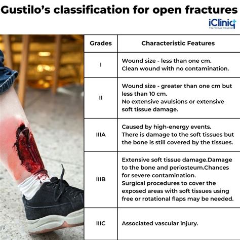 What Are Open Fractures?